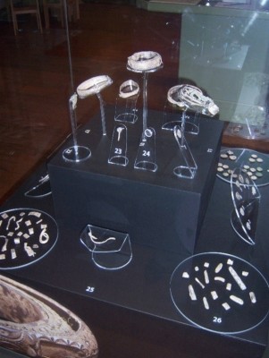 Figure 4. Silverdale Hoard as displayed at Lancaster City Museum (Image copyright: F. Morrissey).